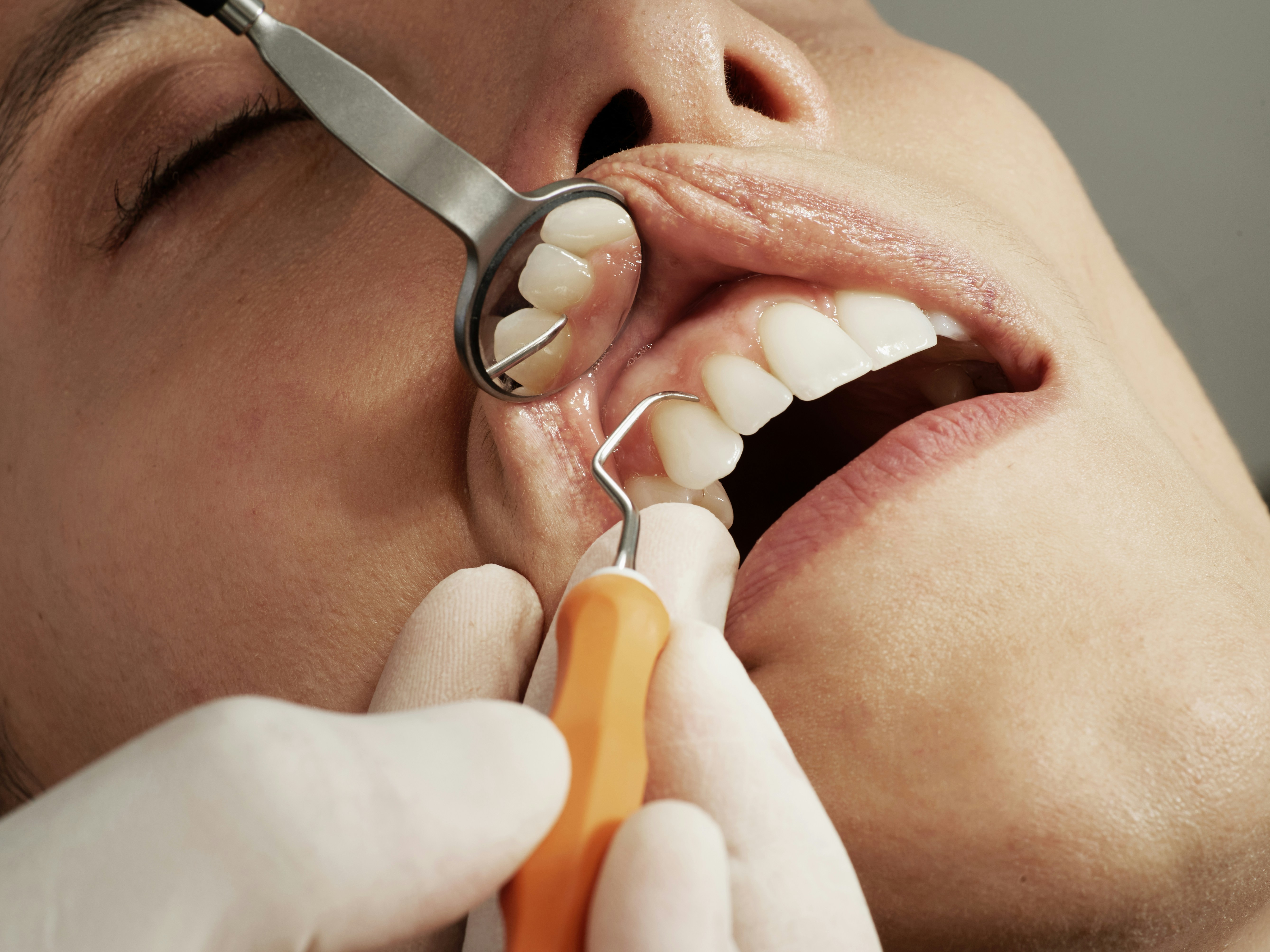 dental exam with mirror and tool